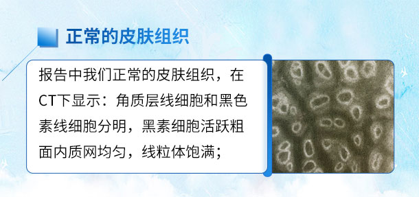 北京专家来啦！！特邀北京白癜风专家——苏有明教授将于4月5日来院会诊