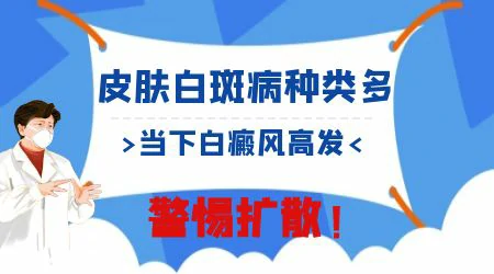 致敬我们心中最敬业的人●五一皮肤白斑诊疗援助开启