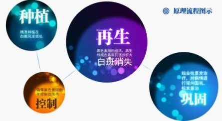 如何治疗白癜风重拾自信生活