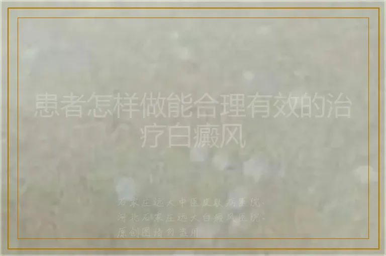 患者怎样做能合理有效的治疗白癜风