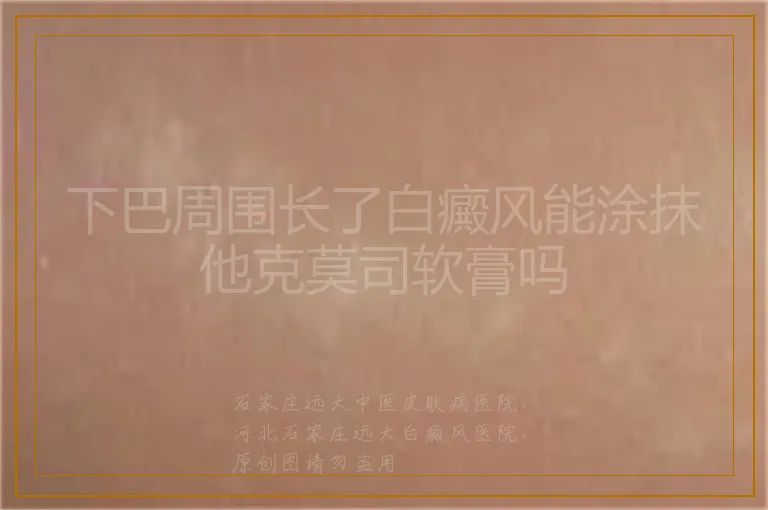 下巴周围长了白癜风能涂抹他克莫司软膏吗