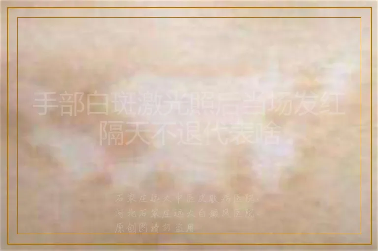 手部白斑激光照后当场发红隔天不退代表啥