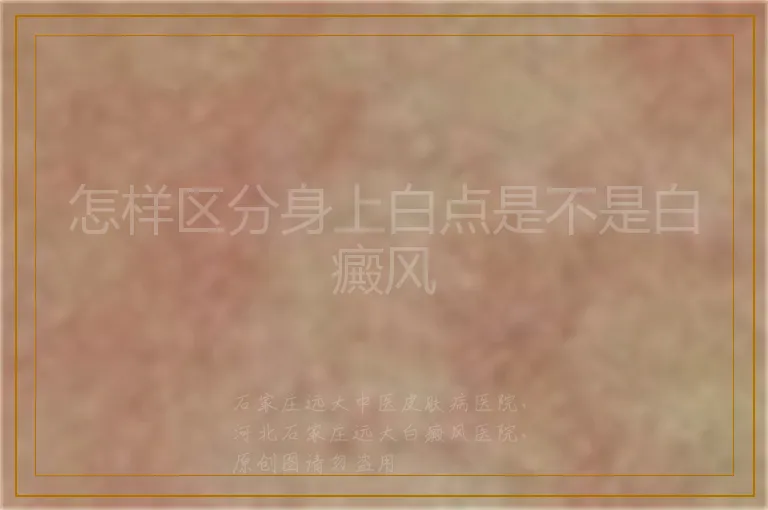 怎样区分身上白点是不是白癜风
