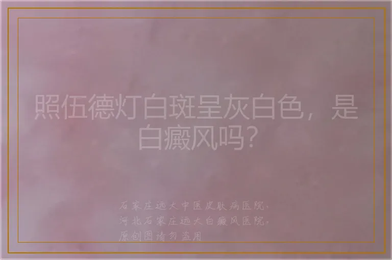 照伍德灯白斑呈灰白色，是白癜风吗？