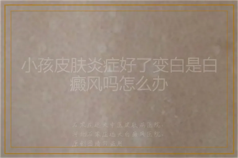 小孩皮肤炎症好了变白是白癜风吗怎么办