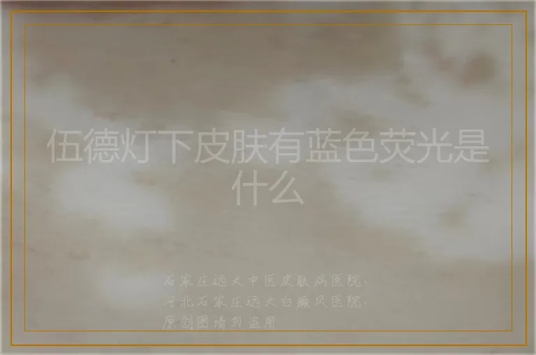伍德灯下皮肤有蓝色荧光是什么
