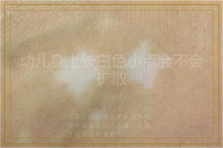 幼儿身上长白色小点会不会扩散