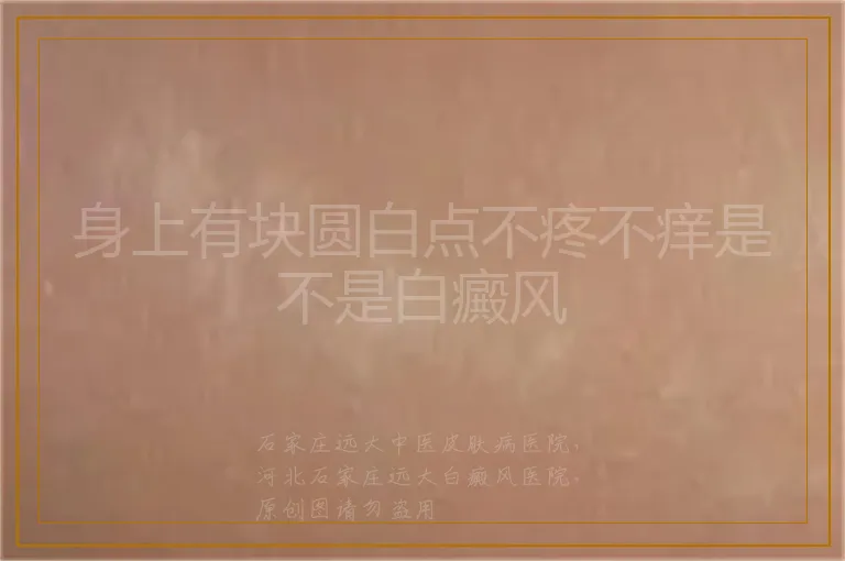 身上有块圆白点不疼不痒是不是白癜风