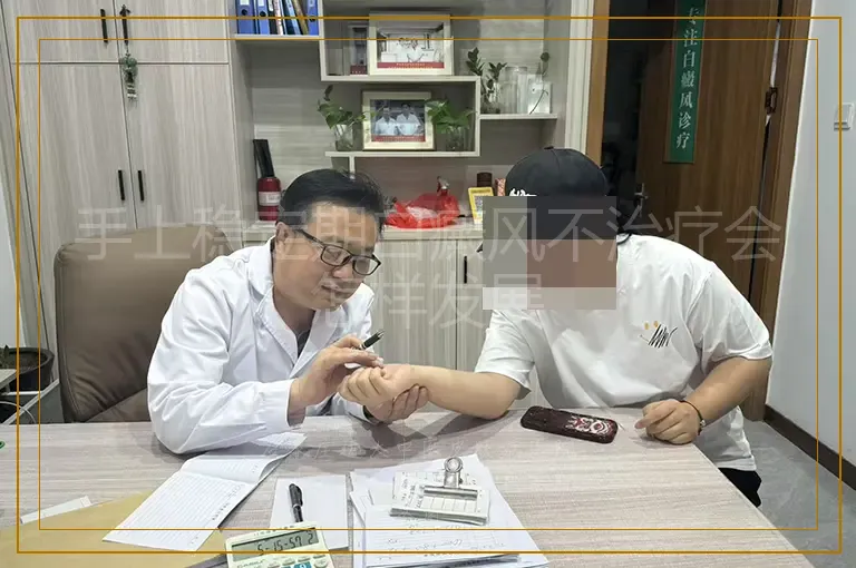 手上稳定期白癜风不治疗会怎样发展
