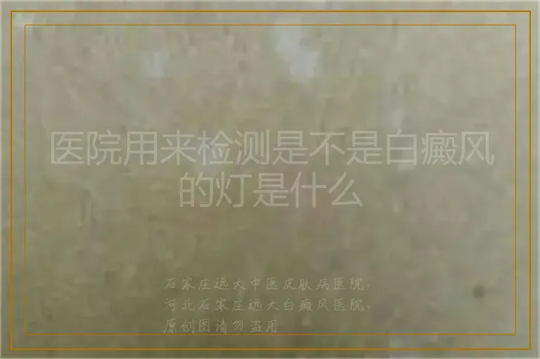 医院用来检测是不是白癜风的灯是什么