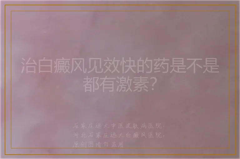 治白癜风见效快的药是不是都有激素?
