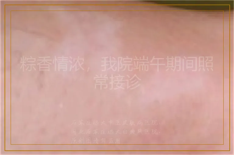 粽香情浓，我院端午期间照常接诊