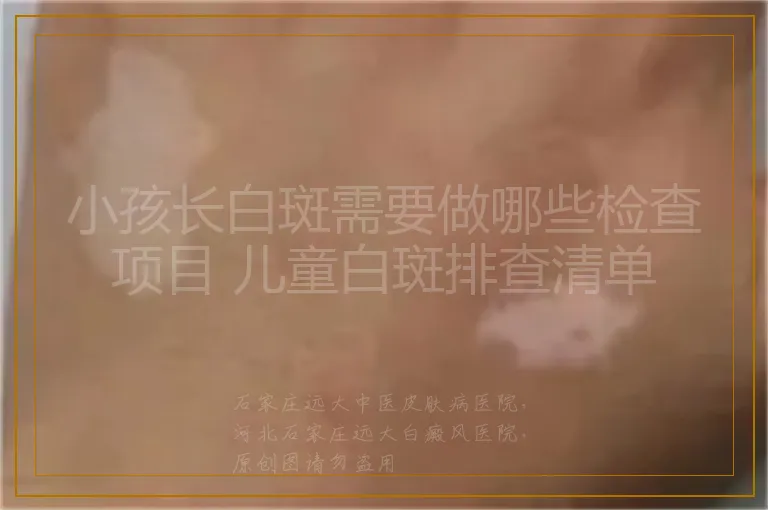 小孩长白斑需要做哪些检查项目 儿童白斑排查清单