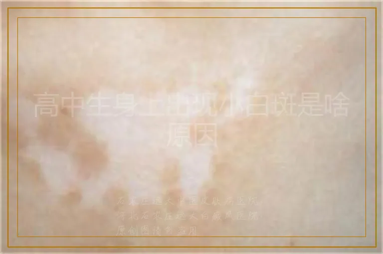 高中生身上出现小白斑是啥原因