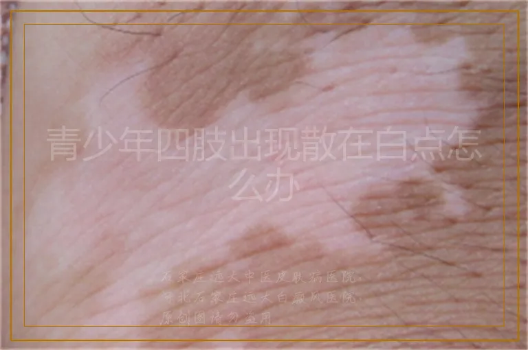 青少年四肢出现散在白点怎么办