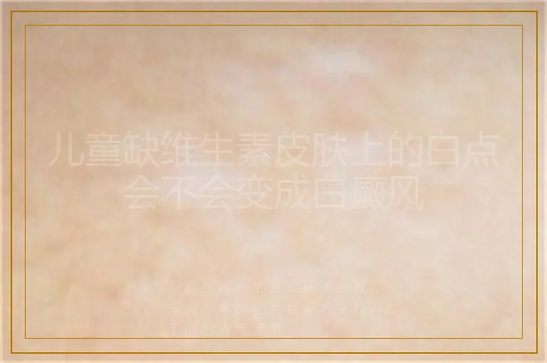 儿童缺维生素皮肤上的白点会不会变成白癜风