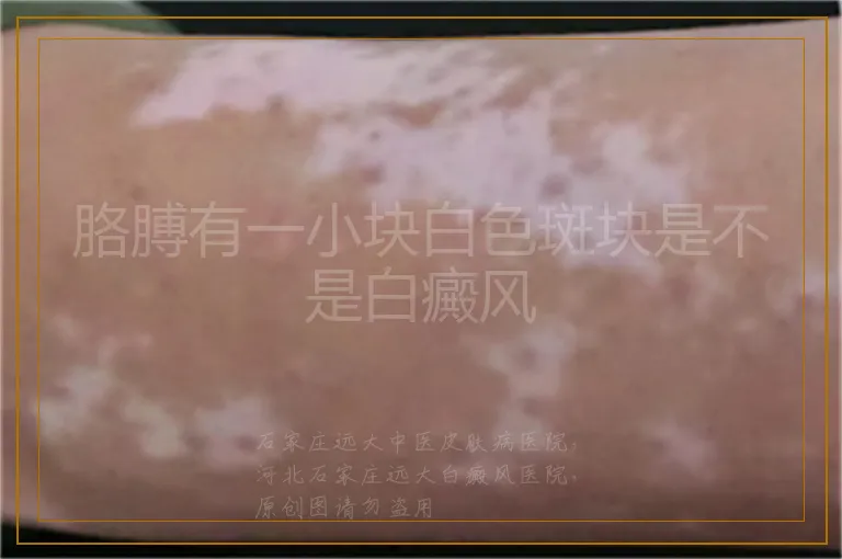 胳膊有一小块白色斑块是不是白癜风