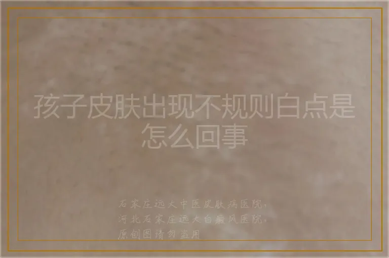 孩子皮肤出现不规则白点是怎么回事