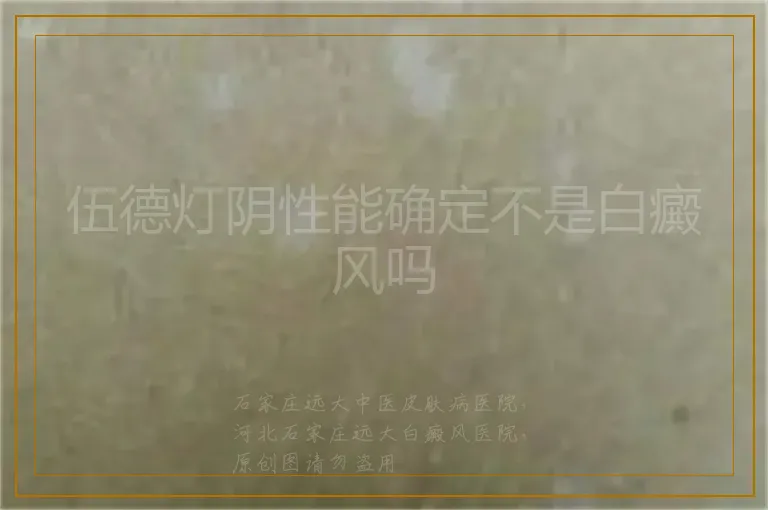 伍德灯阴性能确定不是白癜风吗