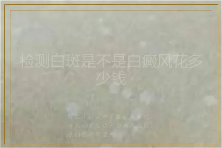 检测白斑是不是白癜风花多少钱