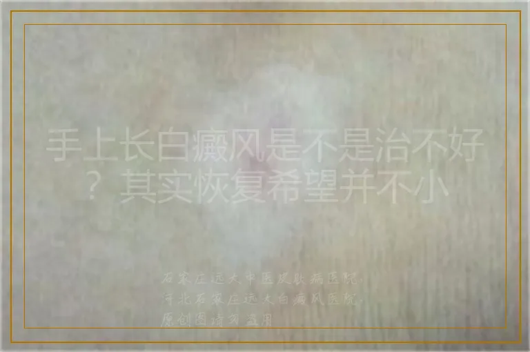 手上长白癜风是不是治不好?其实恢复希望并不小