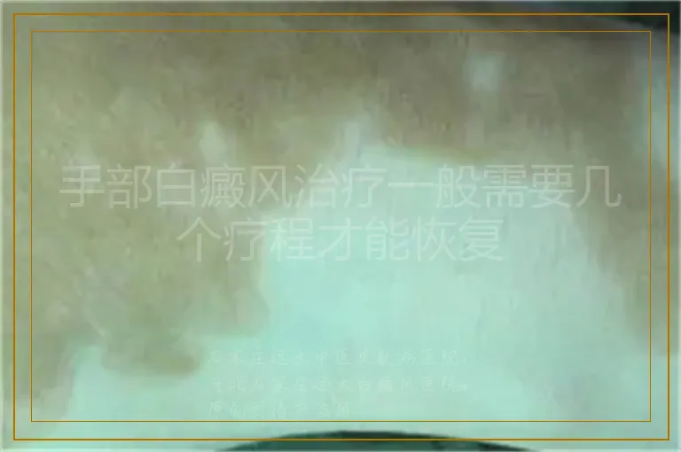 手部白癜风治疗一般需要几个疗程才能恢复