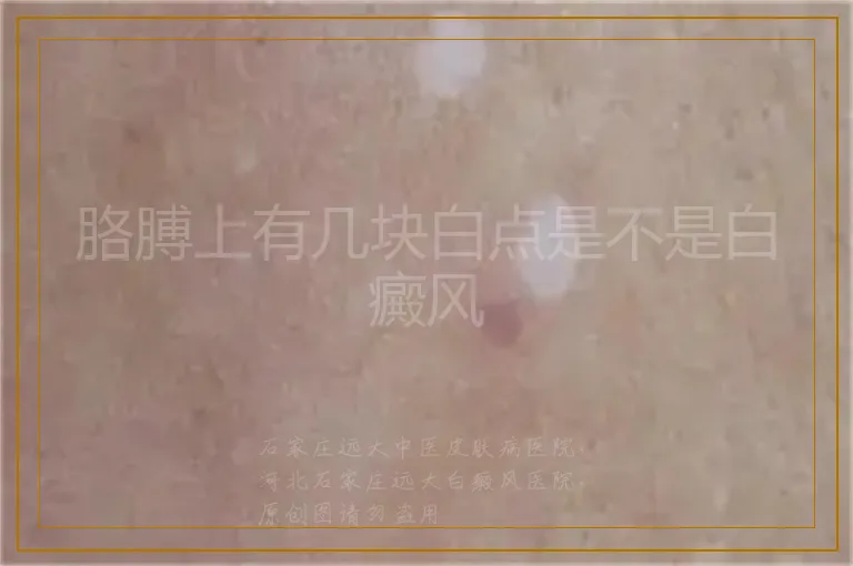 胳膊上有几块白点是不是白癜风