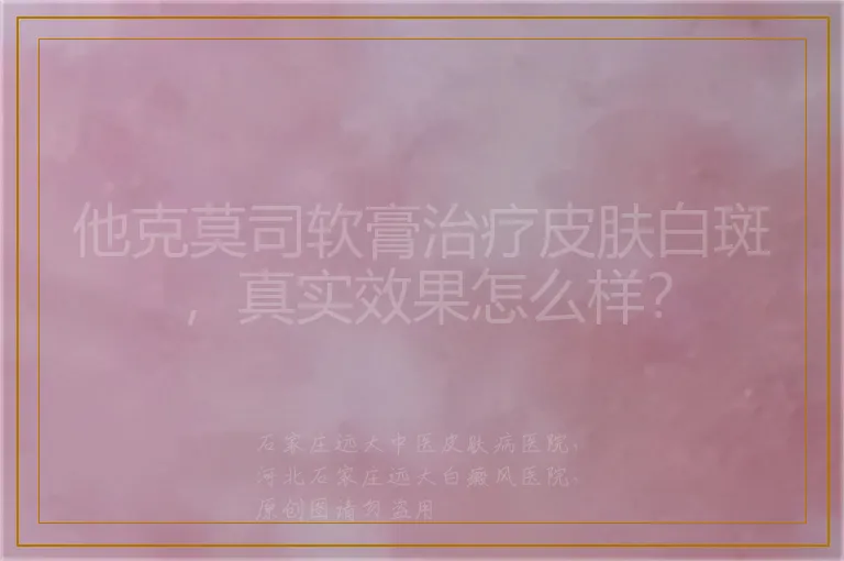他克莫司软膏治疗皮肤白斑,真实效果怎么样?