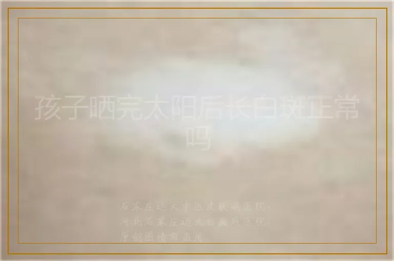 孩子晒完太阳后长白斑正常吗