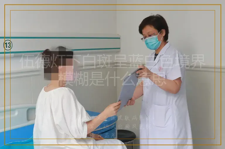 伍德灯下白斑呈蓝白色境界模糊是什么意思