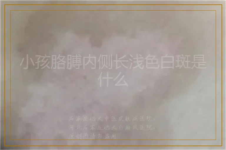 小孩胳膊内侧长浅色白斑是什么