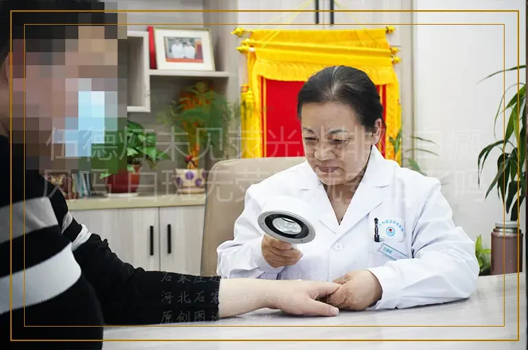伍德灯未见荧光能排除白癜风吗 白斑无荧光就安全了吗
