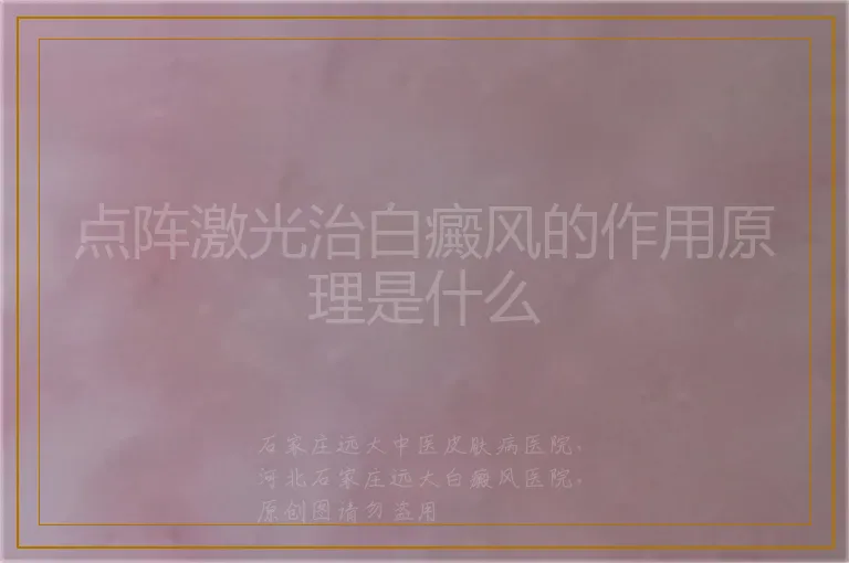 点阵激光治白癜风的作用原理是什么