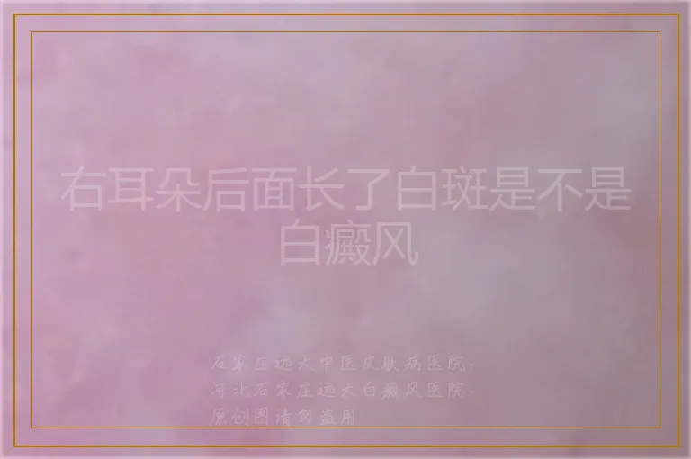 右耳朵后面长了白斑是不是白癜风