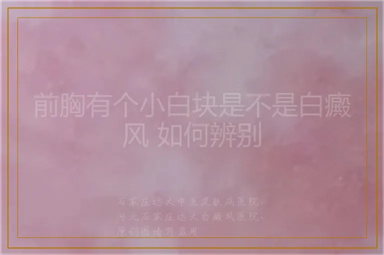前胸有个小白块是不是白癜风 如何辨别