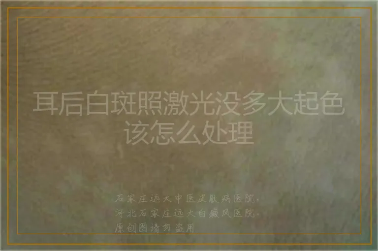 耳后白斑照激光没多大起色该怎么处理