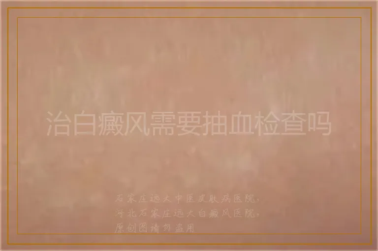 治白癜风需要抽血检查吗