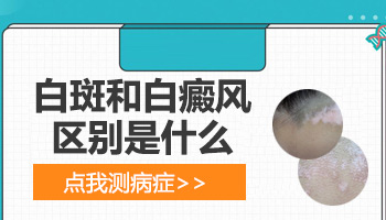 儿童脖颈长白癜风照308激光多长时间有好转