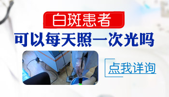 小孩泛发型白癜风初期怎么治不扩散