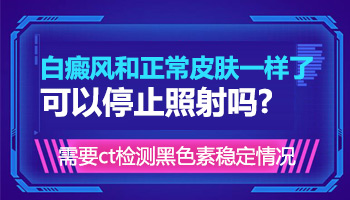 儿童面部长白癜风照308激光发痒怎么回事