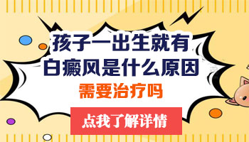 白癜风初期一开始的白就很明显吗