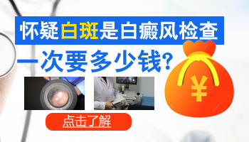 儿童腰部长白癜风怎么治疗科学