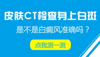 白癜风在治疗的时候有扩散的可能吗