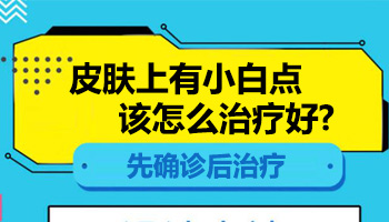 扩散的白斑照进口308激光能控制不