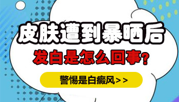 儿童腹部长白癜风一天照几次激光比较合适