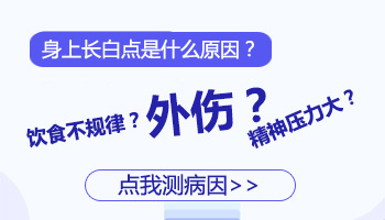 儿童腹部长白癜风照308激光发痒怎么回事