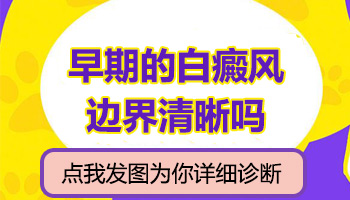 白癜风有没有吃药反而扩散加快的