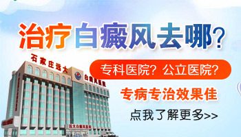 儿童下巴有片白照UVB能治得好吗