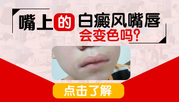 儿童后背有白点怎么用药恢复的快