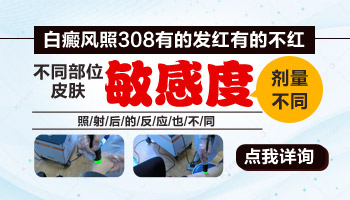 逐渐变大的白癜风中医治疗恢复时间长不长